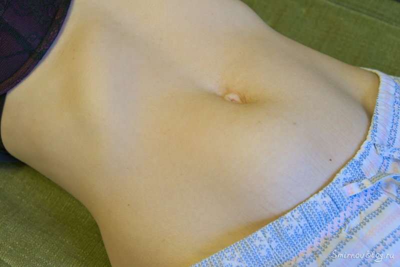 Множественная миома — моя история Множественная миома — моя история